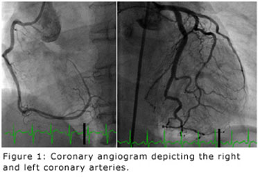 North Houston Cardiac Catheterization