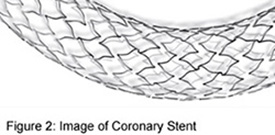 Coronary Stent